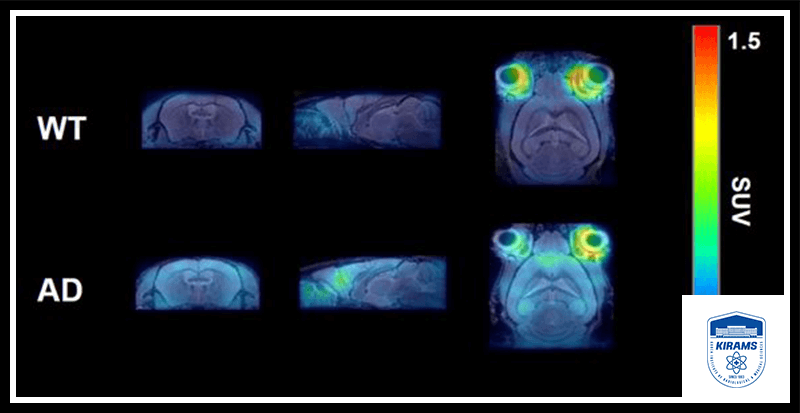 Medical Imaging using PET Scanning